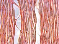 Tangential section